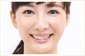 装置が透明で目立たない